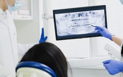 How Long Does A Root Canal Take?