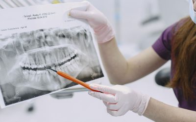 Wisdom Tooth Pain: Symptoms, Treatment and Relief